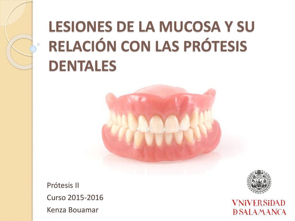 LESIONES DE LA MUCOSA Y SU RELACIÓN CON LAS PRÓTESIS DENTALES
