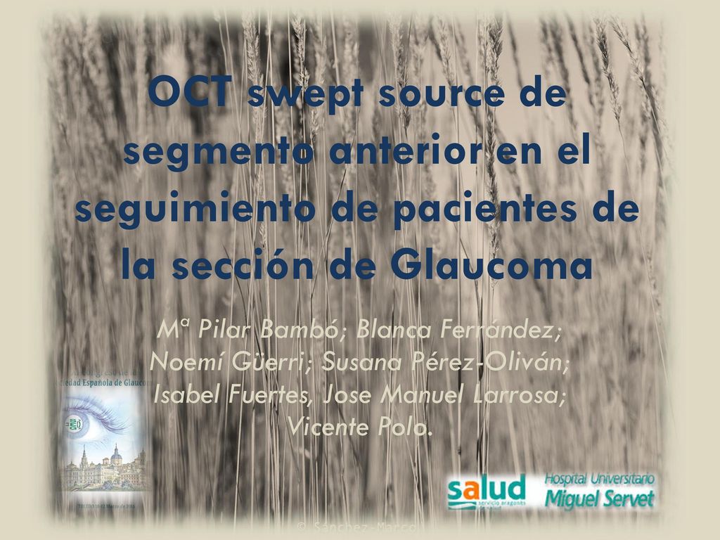 OCT swept source de segmento anterior en el seguimiento de pacientes de la sección de Glaucoma
