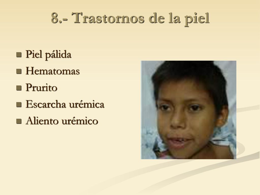 8.- Trastornos de la piel Piel pálida Hematomas Prurito