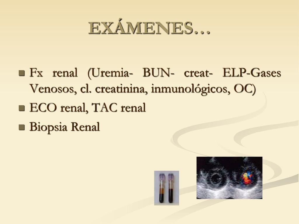 EXÁMENES… Fx renal (Uremia- BUN- creat- ELP-Gases Venosos, cl. creatinina, inmunológicos, OC) ECO renal, TAC renal.