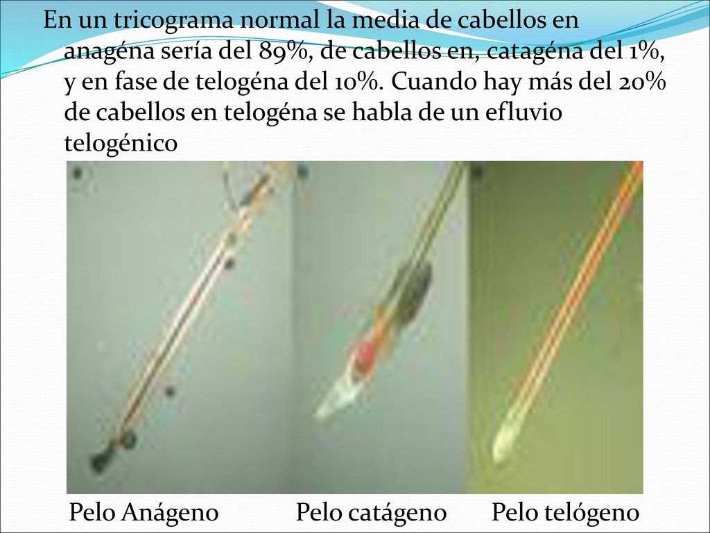 En un tricograma normal la media de cabellos en anagéna sería del 89%, de cabellos en, catagéna del 1%, y en fase de telogéna del 10%. Cuando hay más del 20% de cabellos en telogéna se habla de un efluvio telogénico