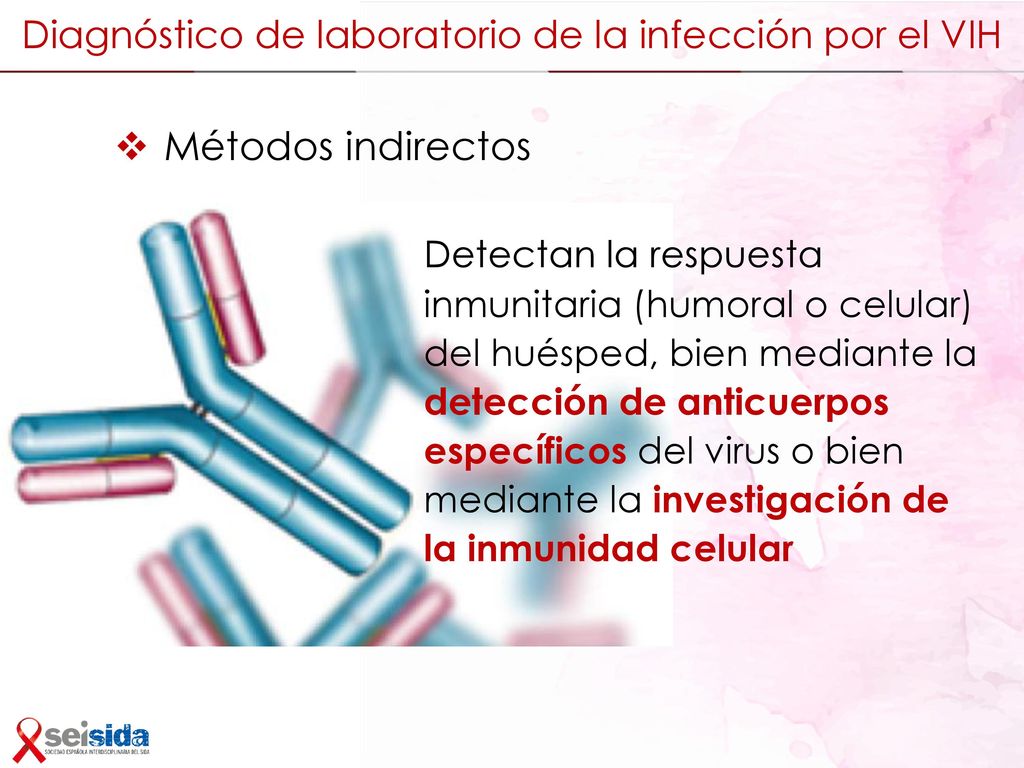 Diagnóstico de laboratorio de la infección por el VIH
