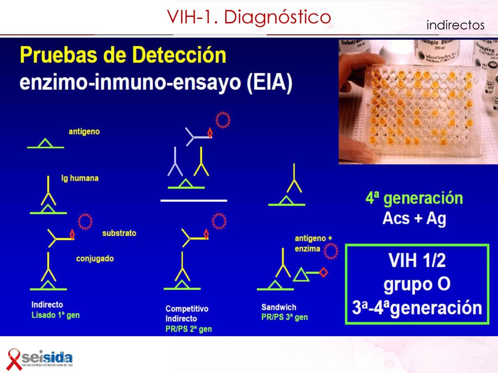 Diagnóstico de laboratorio de la infección por el VIH