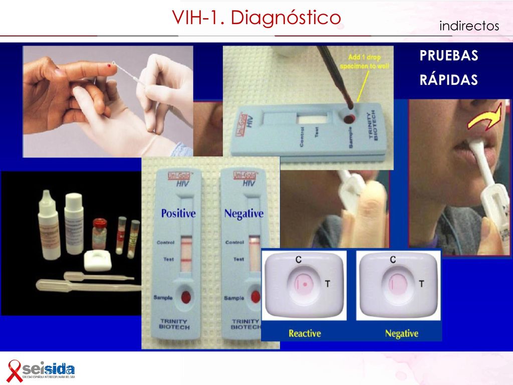 Diagnóstico de laboratorio de la infección por el VIH