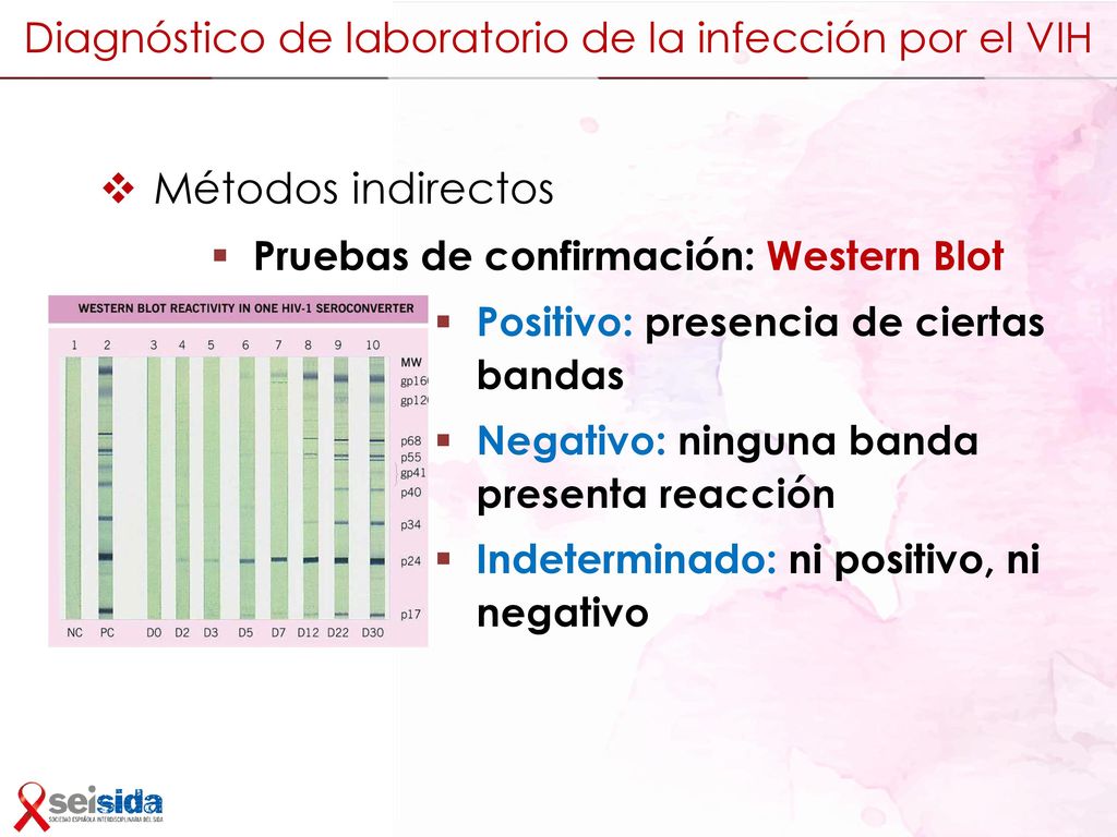 Diagnóstico de laboratorio de la infección por el VIH