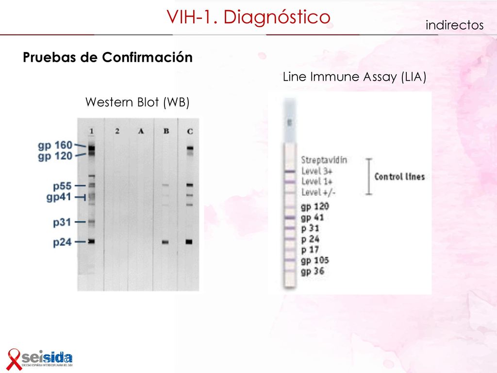 Diagnóstico de laboratorio de la infección por el VIH
