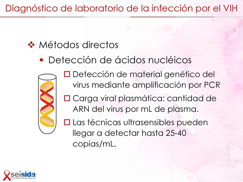 Diagnóstico de laboratorio de la infección por el VIH