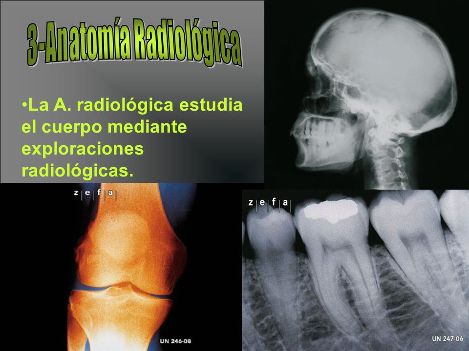 3-Anatomía Radiológica