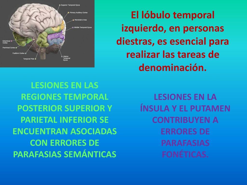 El lóbulo temporal izquierdo, en personas diestras, es esencial para realizar las tareas de denominación.