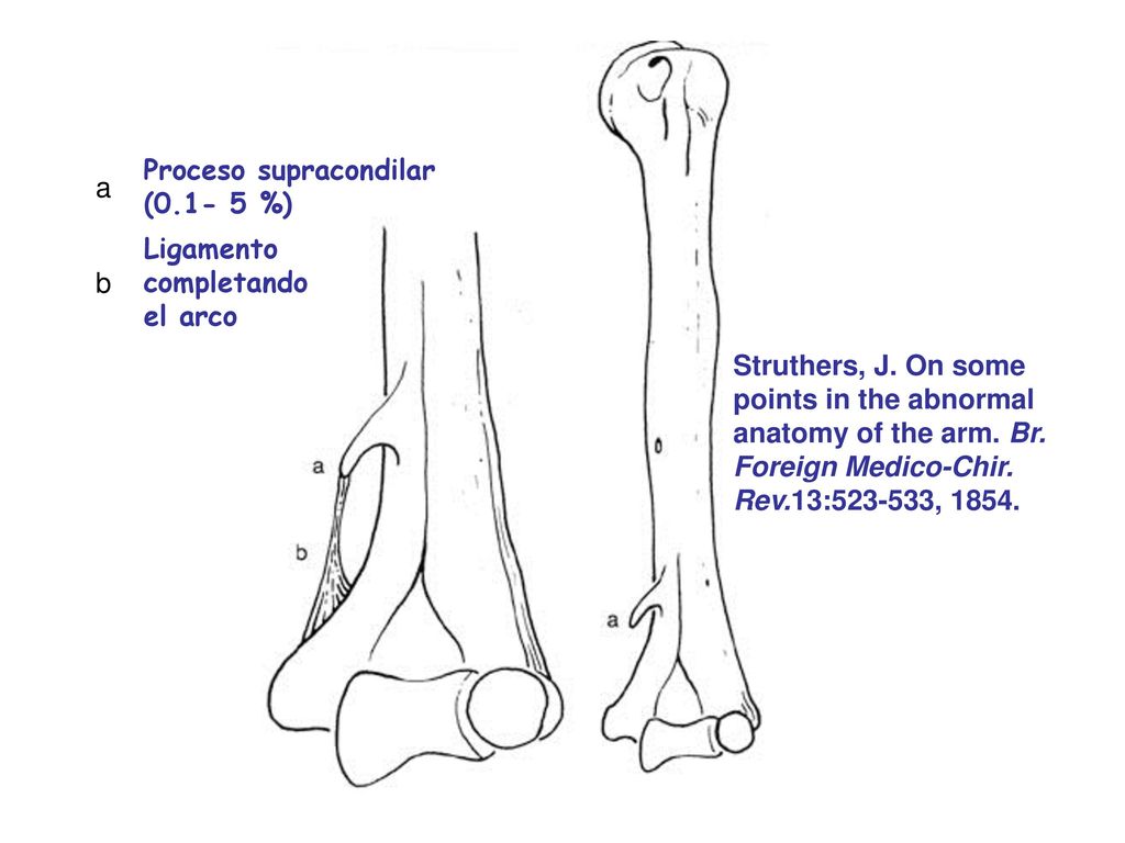 a Proceso supracondilar ( %) b. Ligamento completando. el arco.