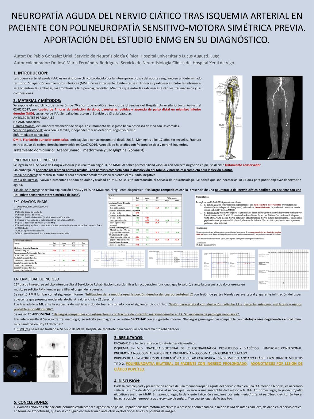 NEUROPATÍA AGUDA DEL NERVIO CIÁTICO TRAS ISQUEMIA ARTERIAL EN PACIENTE CON POLINEUROPATÍA SENSITIVO-MOTORA SIMÉTRICA PREVIA. APORTACIÓN DEL ESTUDIO ENMG EN SU DIAGNÓSTICO.