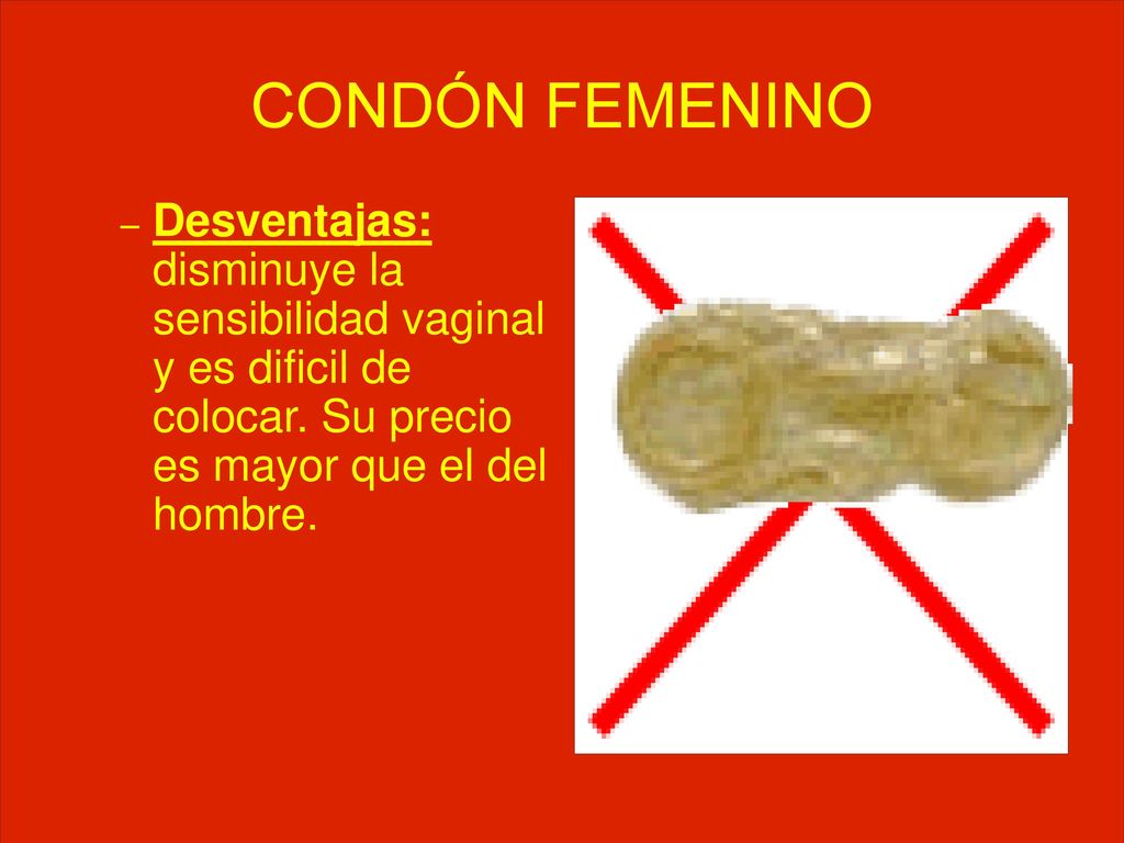 CONDÓN FEMENINO Desventajas: disminuye la sensibilidad vaginal y es dificil de colocar.