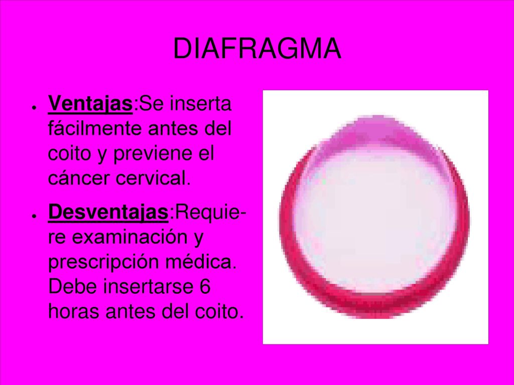 DIAFRAGMA Ventajas:Se inserta fácilmente antes del coito y previene el cáncer cervical.