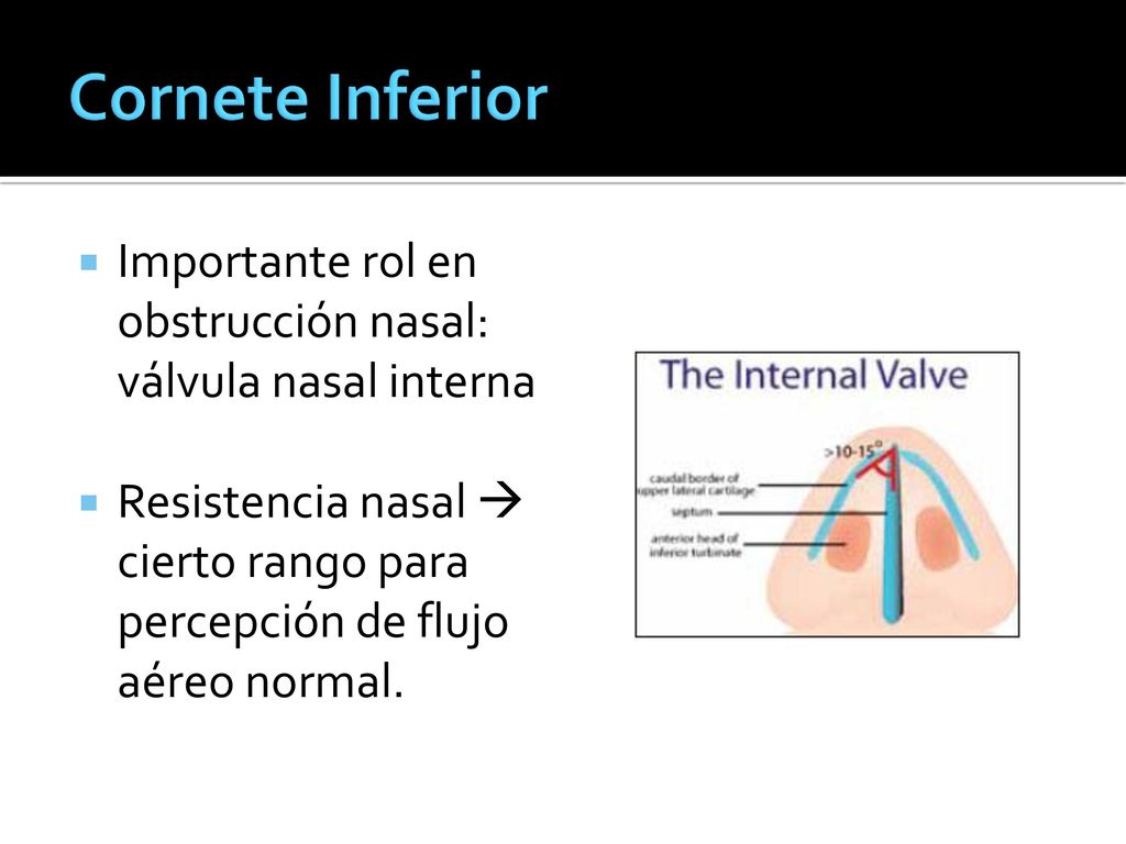 Cornete Inferior Importante rol en obstrucción nasal: válvula nasal interna. Resistencia nasal  cierto rango para percepción de flujo aéreo normal.