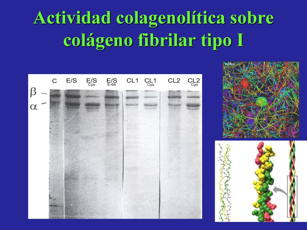 Actividad colagenolítica sobre colágeno fibrilar tipo I