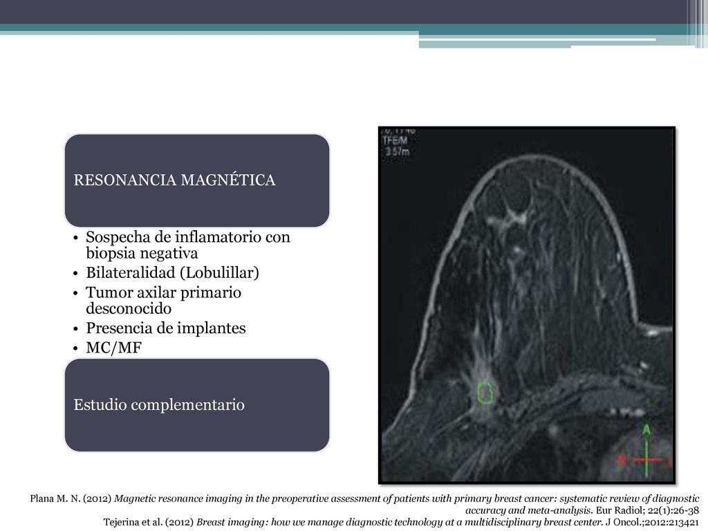 Sospecha de inflamatorio con biopsia negativa
