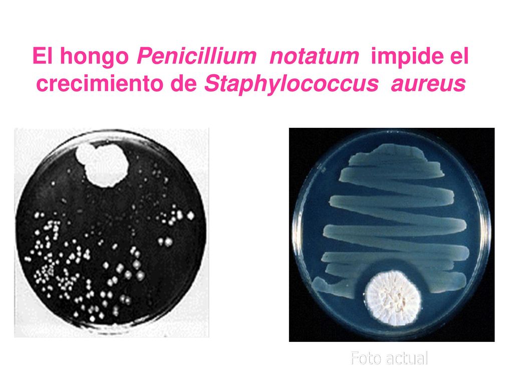 El hongo Penicillium notatum impide el crecimiento de Staphylococcus aureus