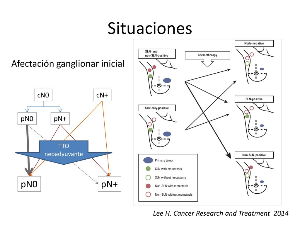 Situaciones Afectación ganglionar inicial pN0 pN+ cN0 cN+ pN0 pN+