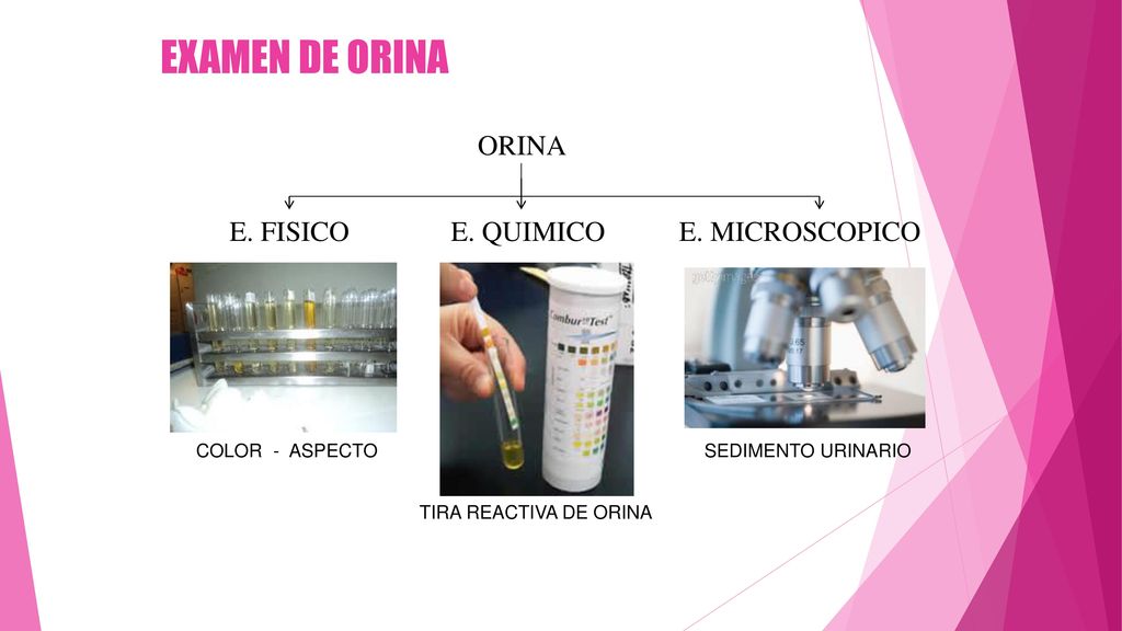 EXAMEN DE ORINA ORINA E. FISICO E. QUIMICO E. MICROSCOPICO