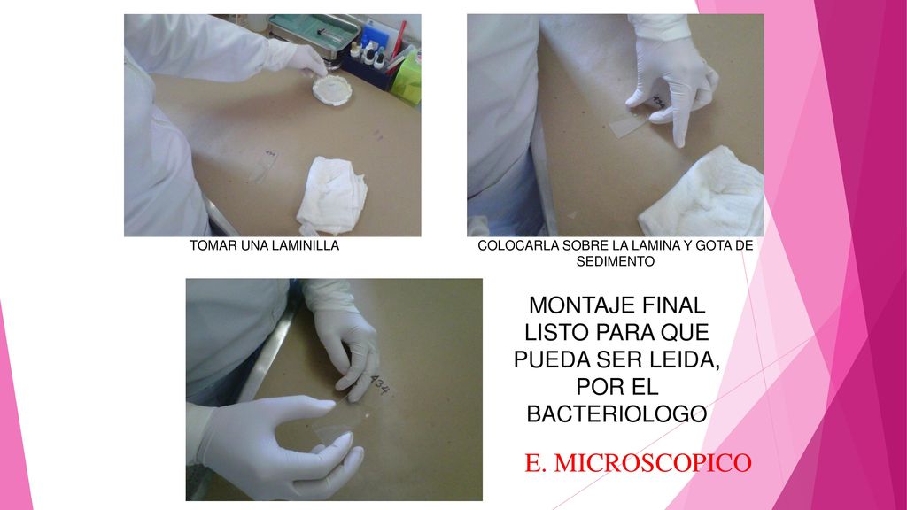 TOMAR UNA LAMINILLA COLOCARLA SOBRE LA LAMINA Y GOTA DE SEDIMENTO. MONTAJE FINAL LISTO PARA QUE PUEDA SER LEIDA, POR EL BACTERIOLOGO.