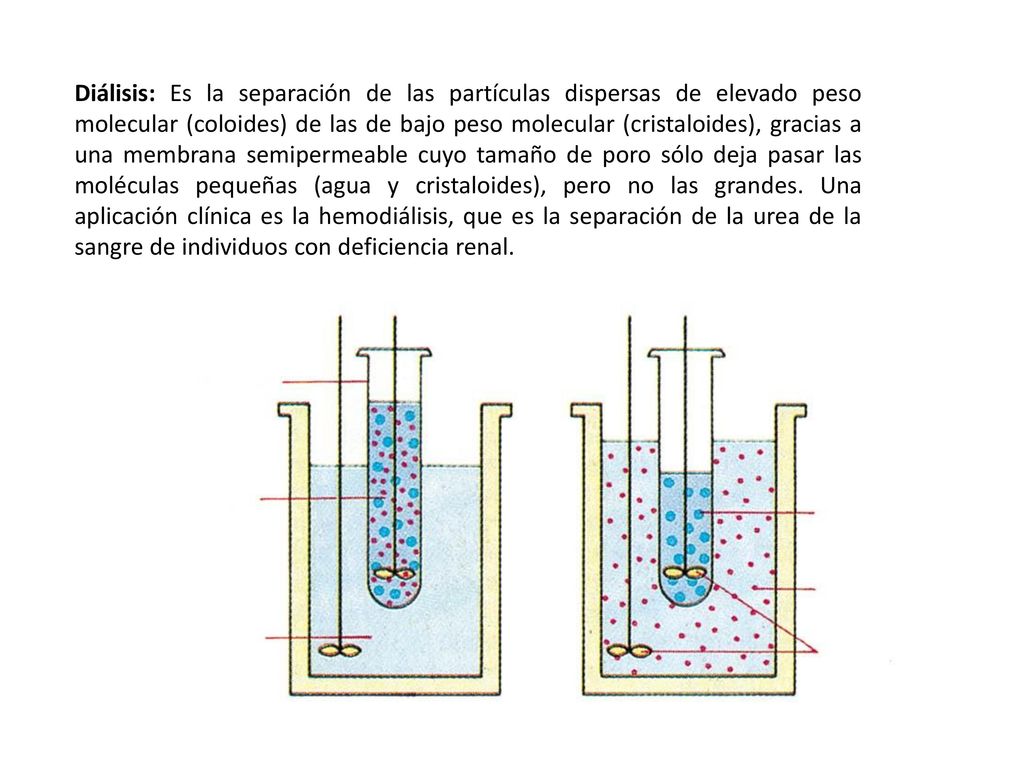 Diálisis: Es la separación de las partículas dispersas de elevado peso molecular (coloides) de las de bajo peso molecular (cristaloides), gracias a una membrana semipermeable cuyo tamaño de poro sólo deja pasar las moléculas pequeñas (agua y cristaloides), pero no las grandes.
