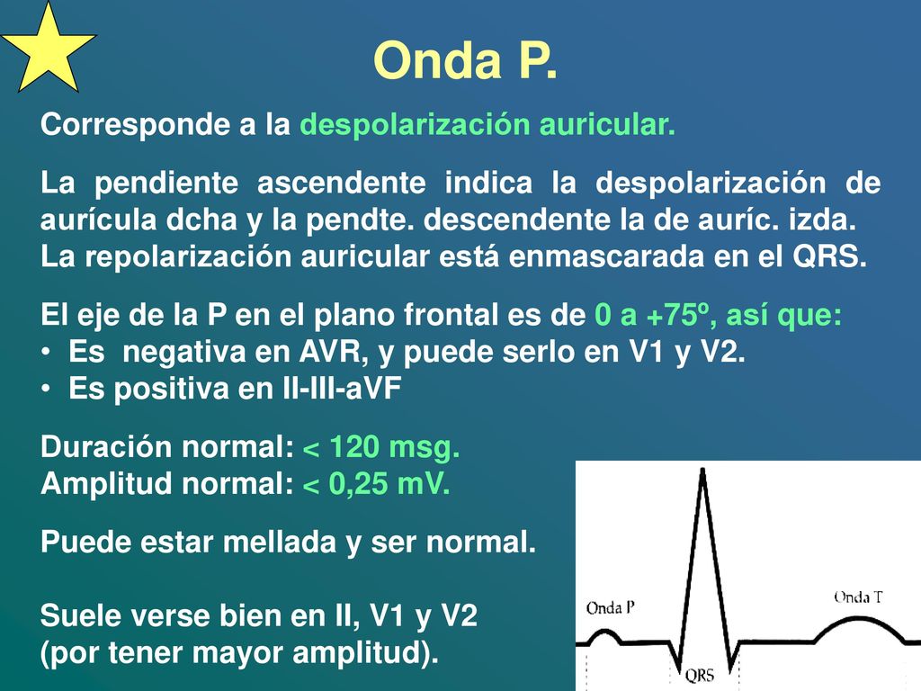 Onda P. Corresponde a la despolarización auricular.