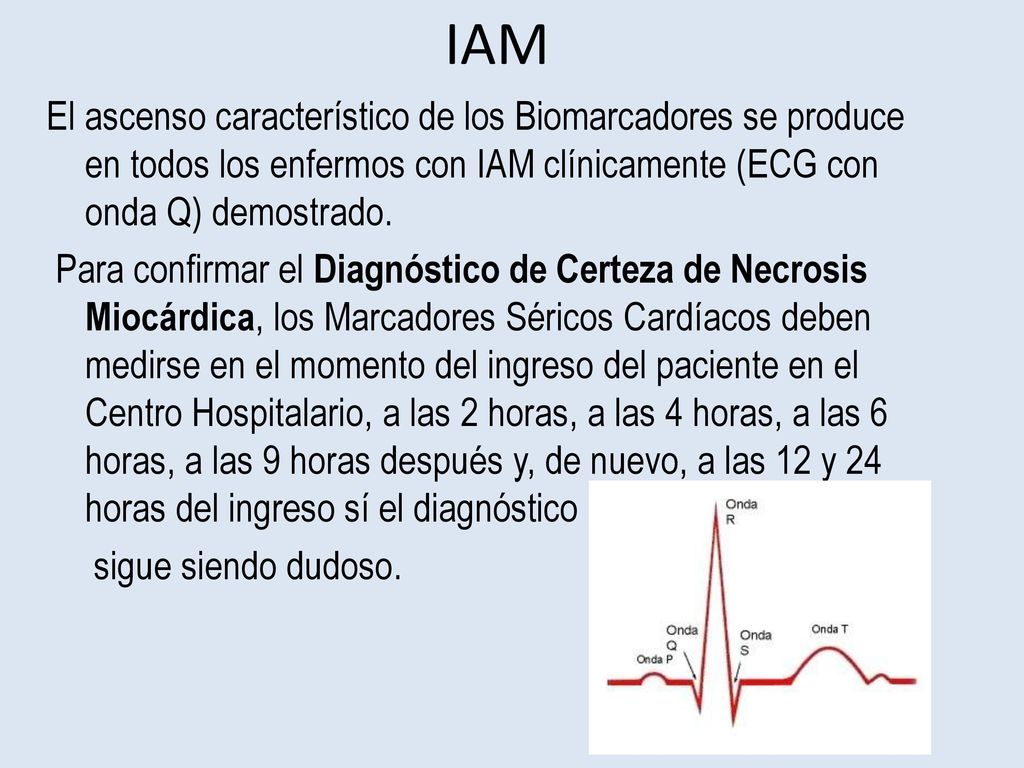 IAM El ascenso característico de los Biomarcadores se produce en todos los enfermos con IAM clínicamente (ECG con onda Q) demostrado.