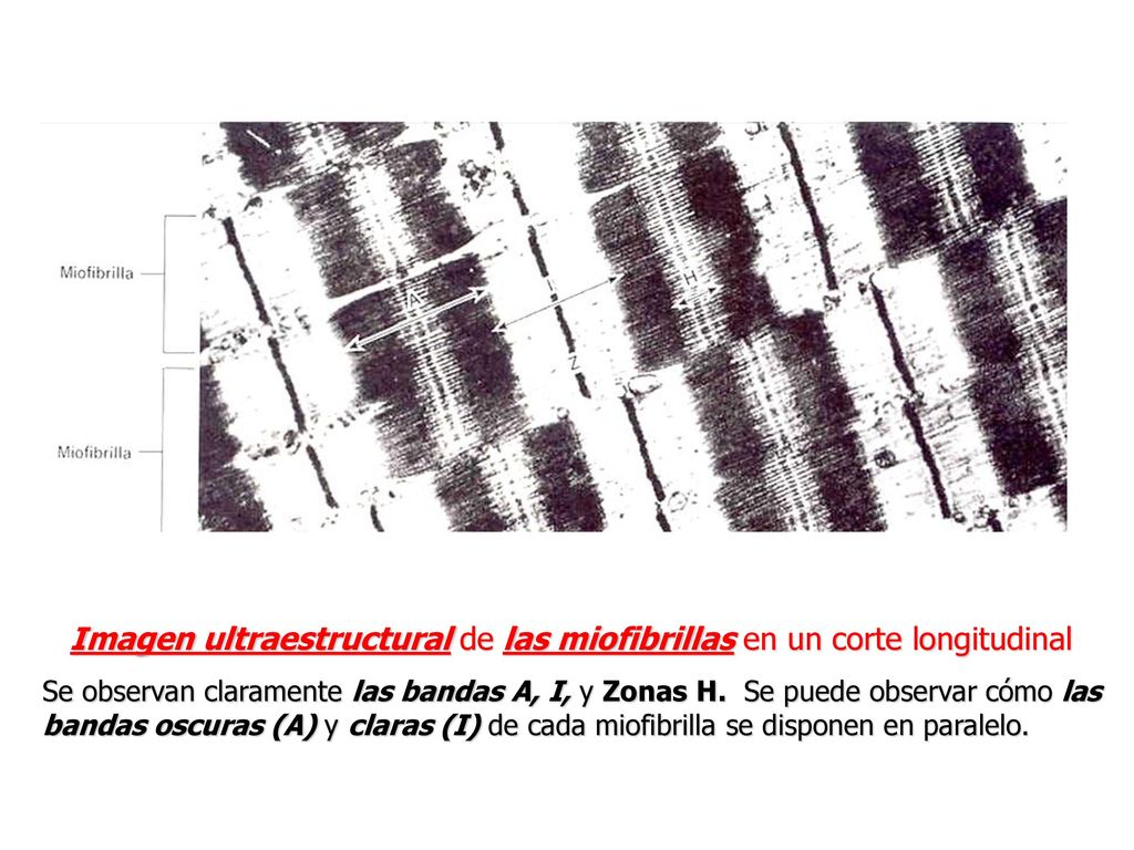 Imagen ultraestructural de las miofibrillas en un corte longitudinal