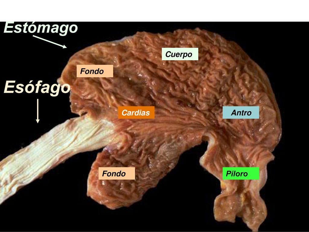 Estómago Cuerpo Fondo Esófago Cardias Antro Fondo Píloro 31/10/2017
