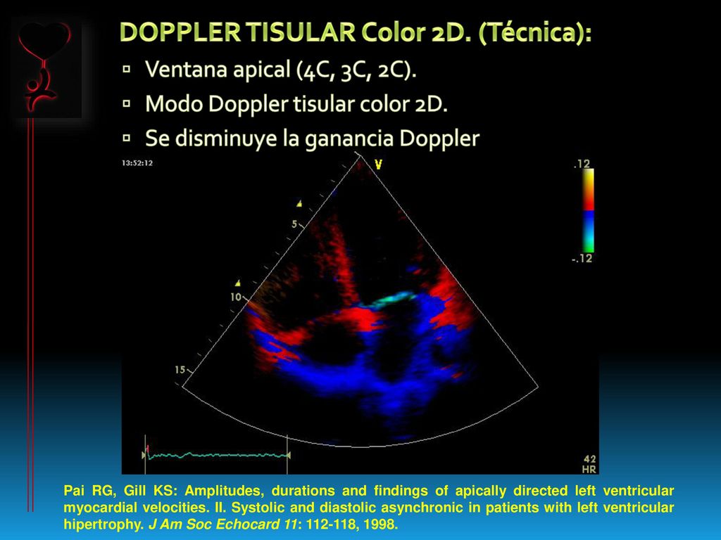 DOPPLER TISULAR Color 2D. (Técnica):