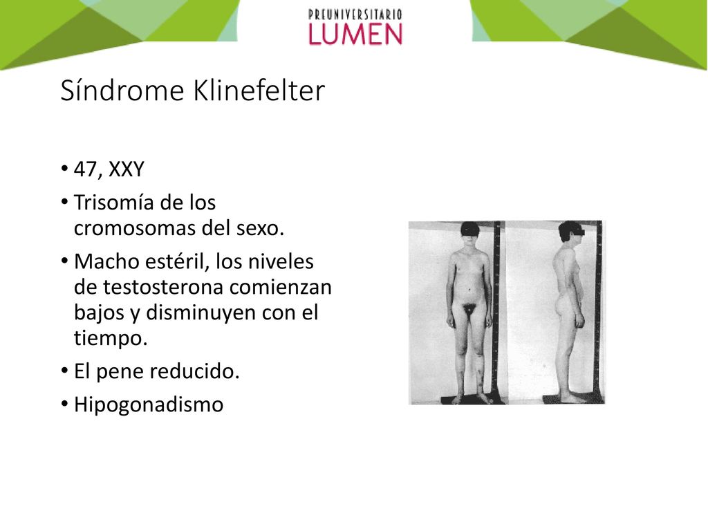 Síndrome Klinefelter 47, XXY Trisomía de los cromosomas del sexo.