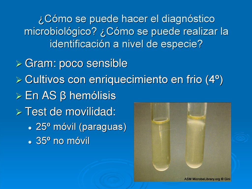 Cultivos con enriquecimiento en frio (4º) En AS β hemólisis