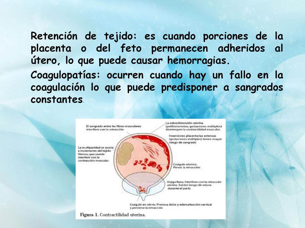Retención de tejido: es cuando porciones de la placenta o del feto permanecen adheridos al útero, lo que puede causar hemorragias.