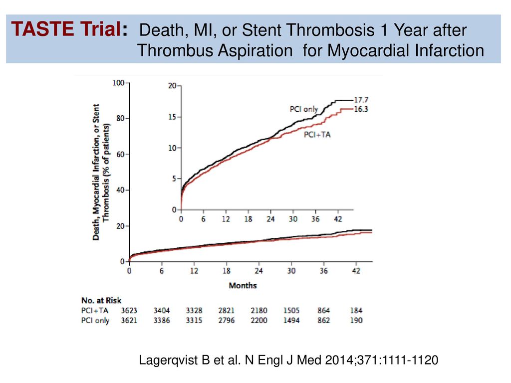 Radial versus femoral randomized investigation in ST-segment elevation acute coronary syndrome: the RIFLE-STEACS (Radial Versus Femoral Randomized Investigation in ST-Elevation Acute Coronary Syndrome) study.