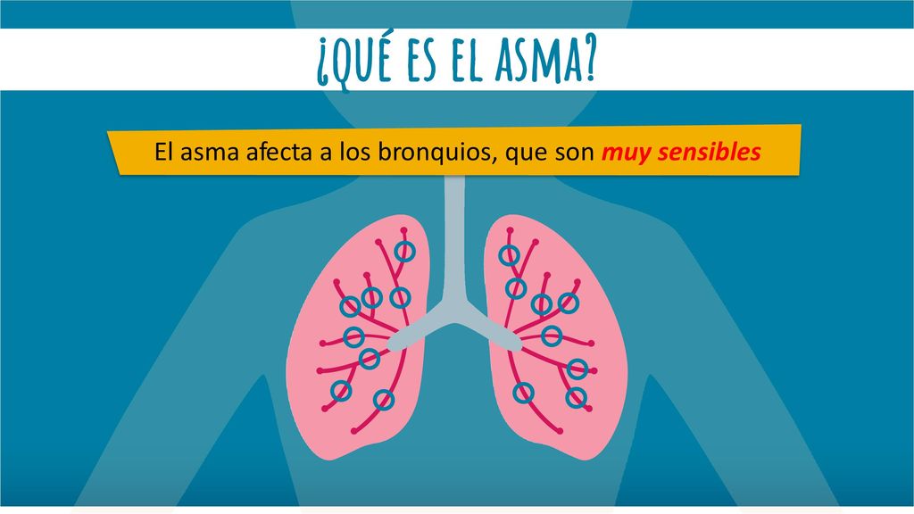 El asma afecta a los bronquios, que son muy sensibles