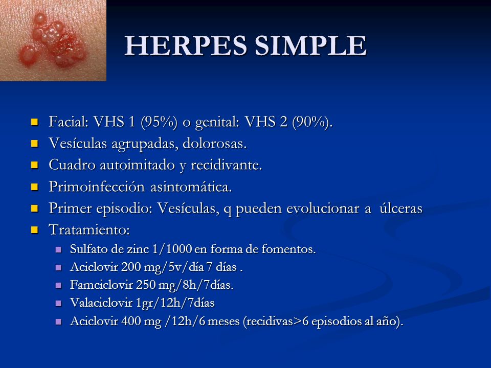 HERPES SIMPLE Facial: VHS 1 (95%) o genital: VHS 2 (90%).