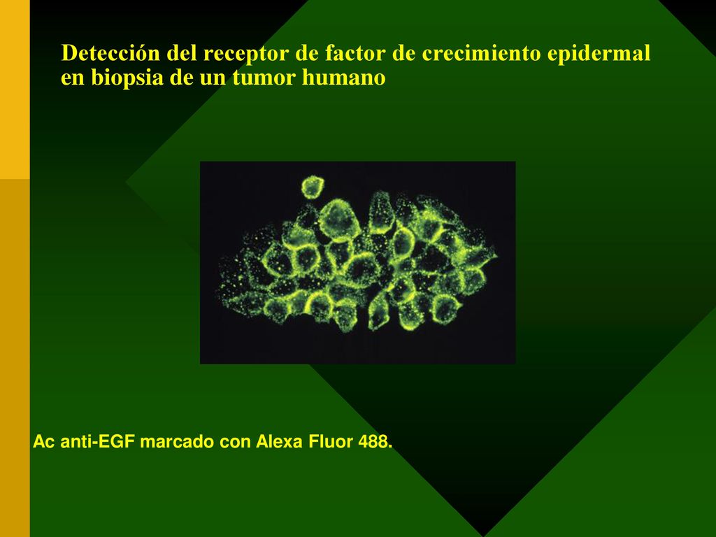 Detección del receptor de factor de crecimiento epidermal en biopsia de un tumor humano