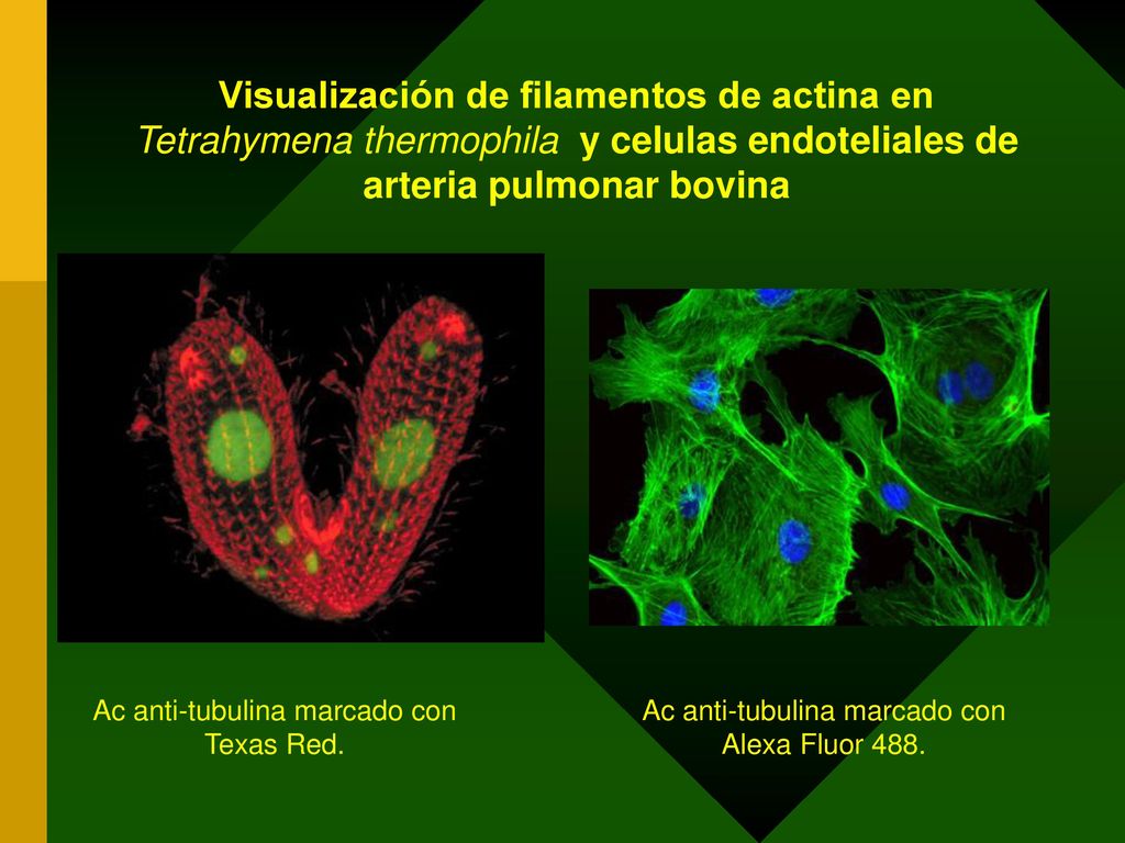 Visualización de filamentos de actina en Tetrahymena thermophila y celulas endoteliales de arteria pulmonar bovina