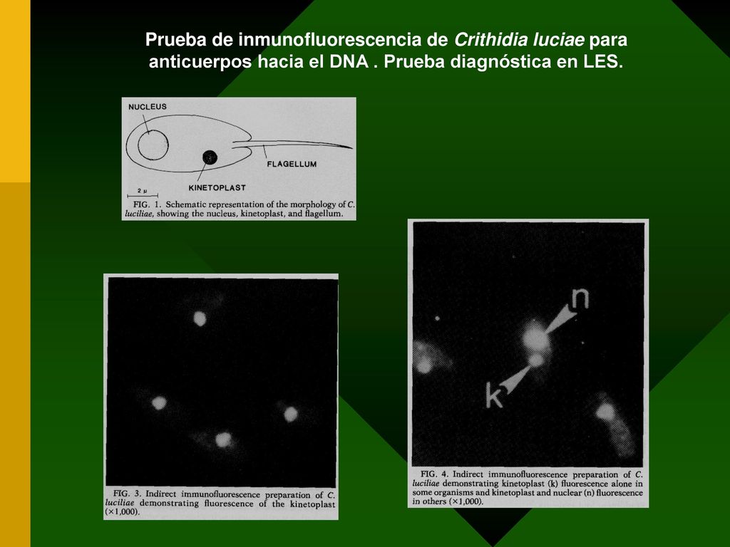 Prueba de inmunofluorescencia de Crithidia luciae para anticuerpos hacia el DNA .