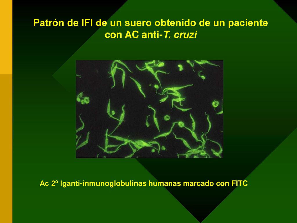 Patrón de IFI de un suero obtenido de un paciente con AC anti-T. cruzi