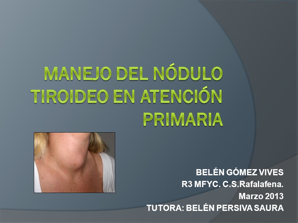 Manejo del nódulo tiroideo en atención primaria