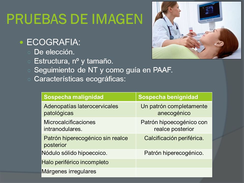 PRUEBAS DE IMAGEN ECOGRAFIA: De elección. Estructura, nº y tamaño.