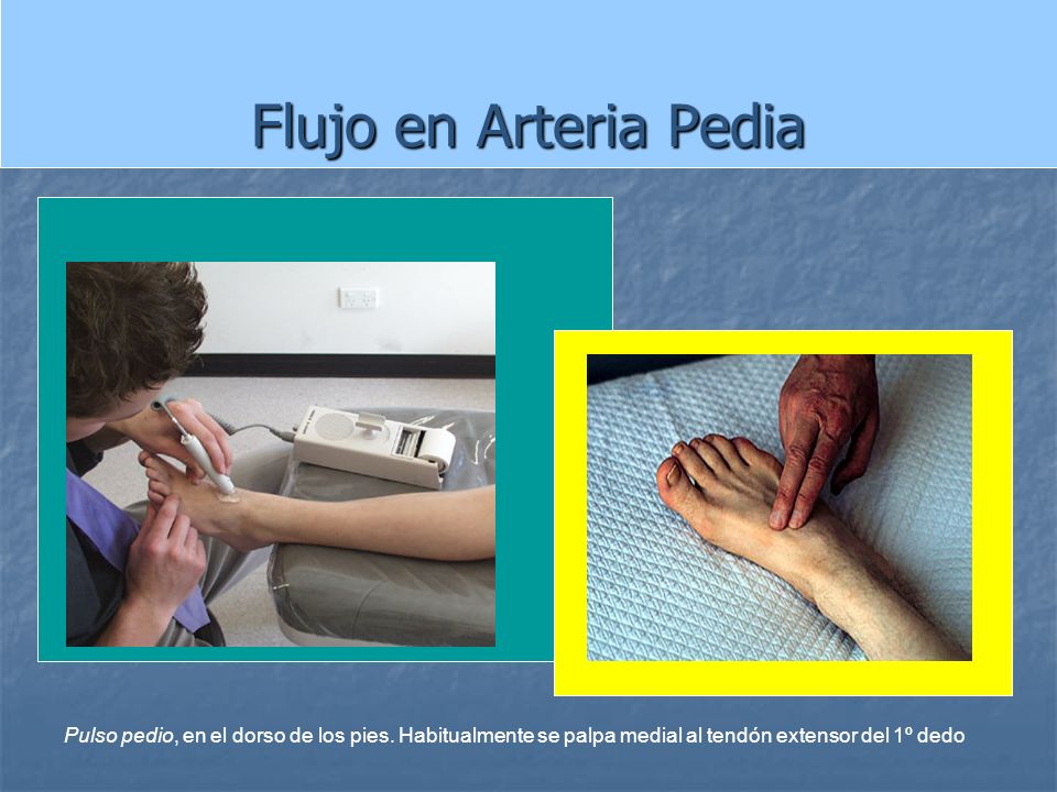 Flujo en Arteria Pedia Pulso pedio, en el dorso de los pies.