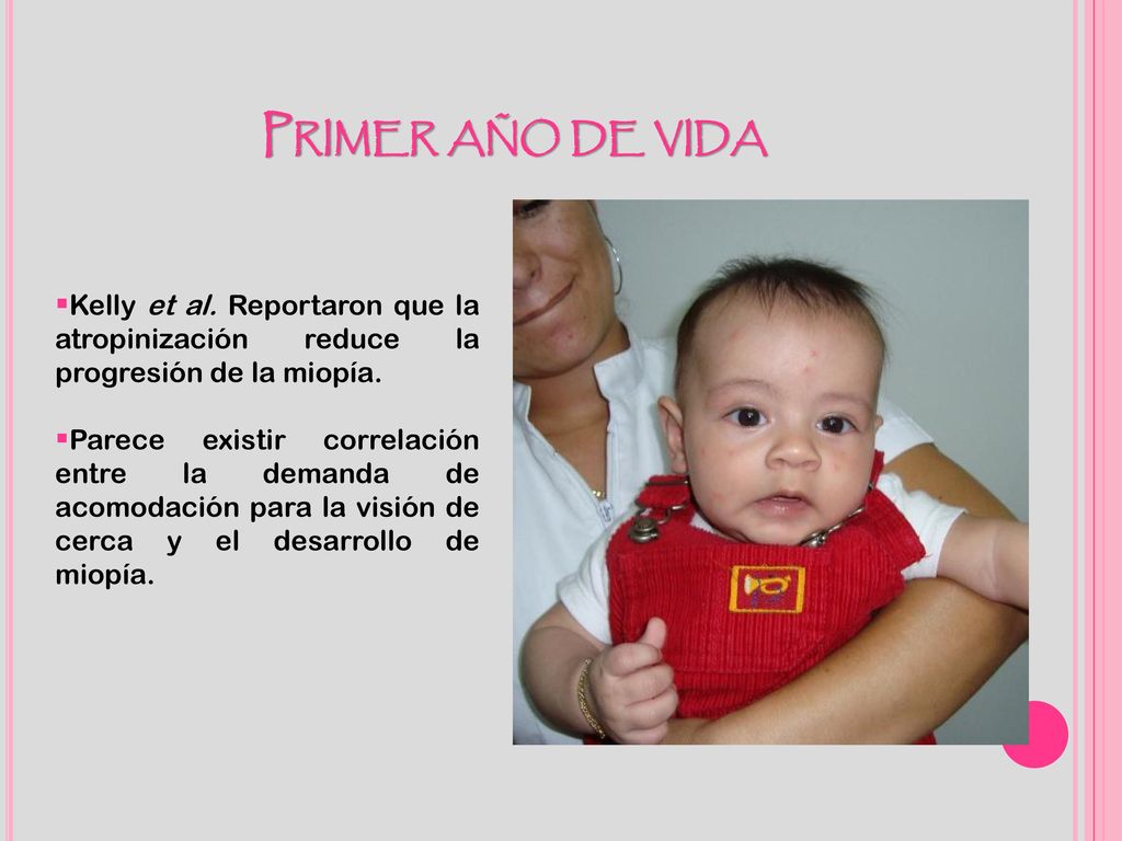 Primer año de vida Kelly et al. Reportaron que la atropinización reduce la progresión de la miopía.