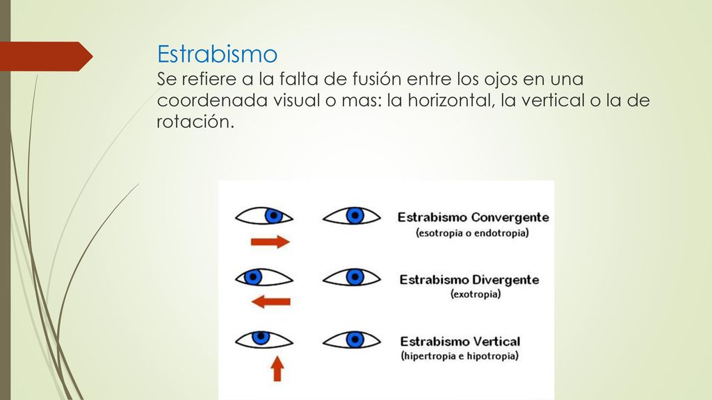 Estrabismo Se refiere a la falta de fusión entre los ojos en una coordenada visual o mas: la horizontal, la vertical o la de rotación.