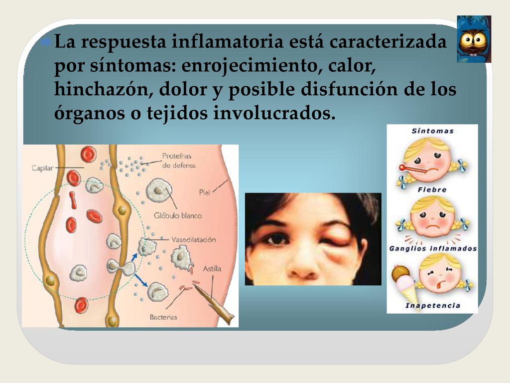 La respuesta inflamatoria está caracterizada por síntomas: enrojecimiento, calor, hinchazón, dolor y posible disfunción de los órganos o tejidos involucrados.