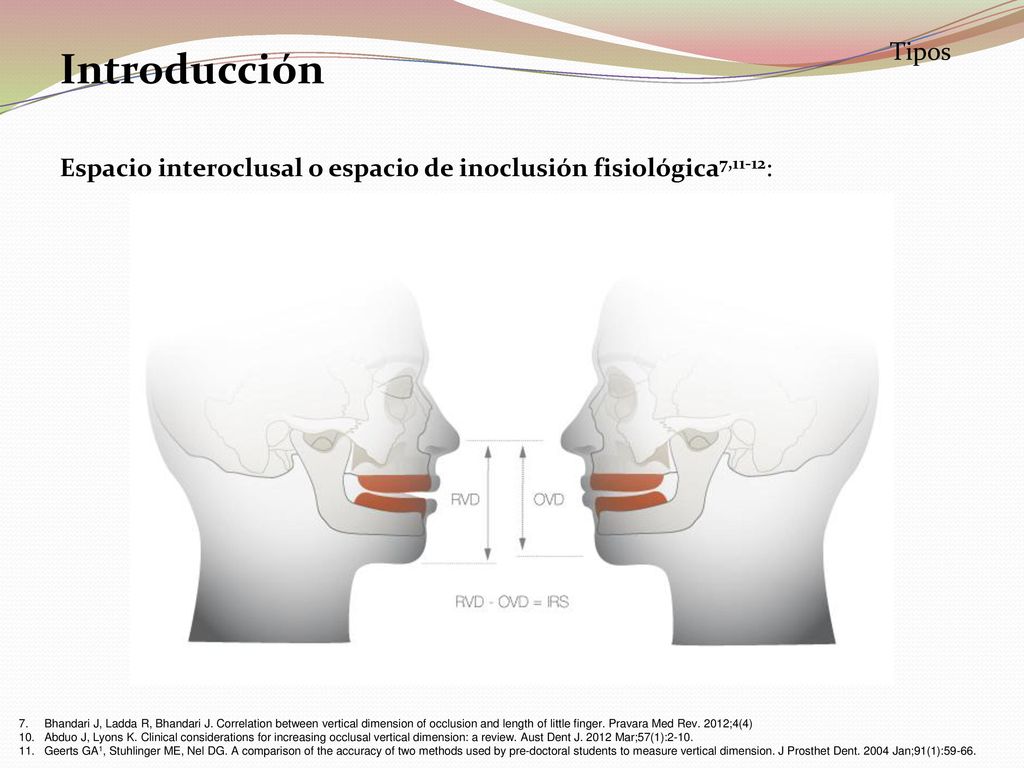 Tipos Introducción. Espacio interoclusal o espacio de inoclusión fisiológica7,11-12: