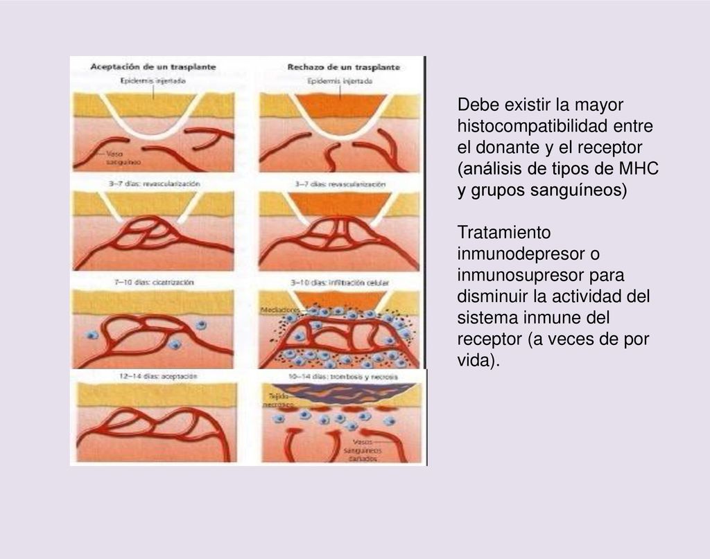 Debe existir la mayor histocompatibilidad entre el donante y el receptor (análisis de tipos de MHC y grupos sanguíneos)