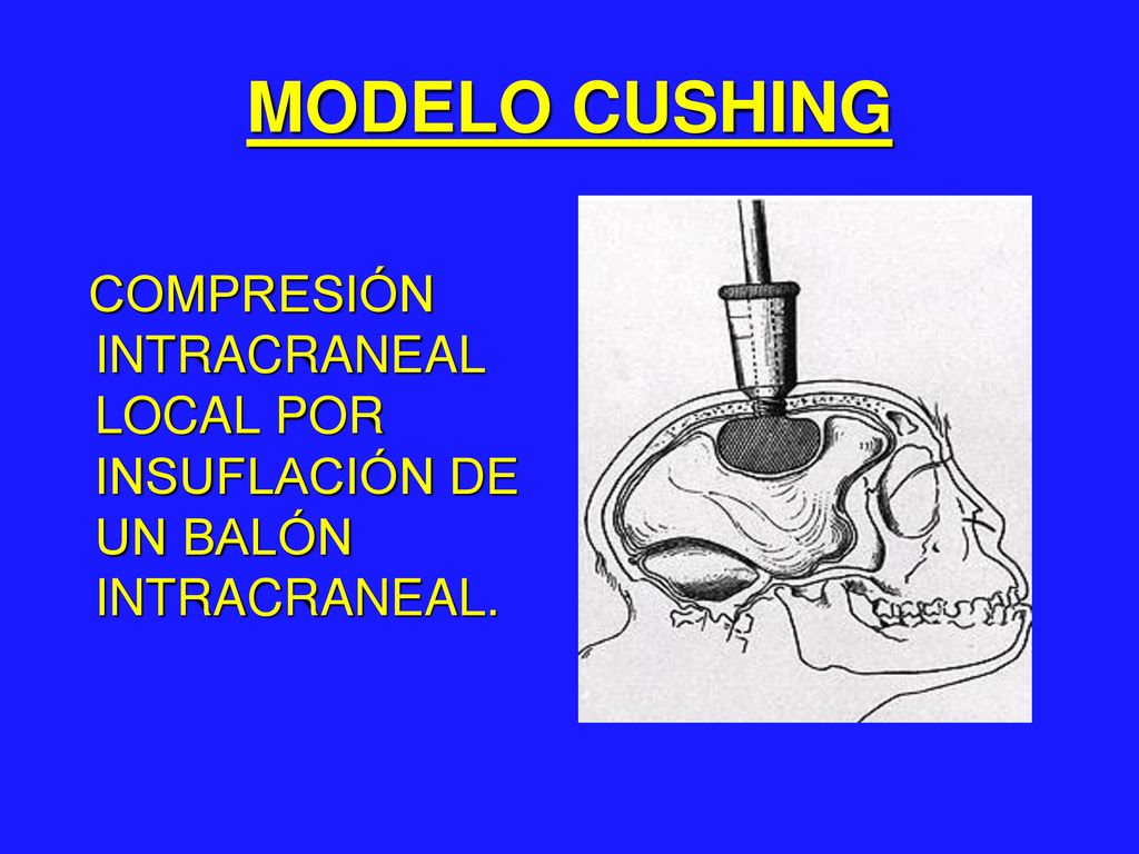 MODELO CUSHING COMPRESIÓN INTRACRANEAL LOCAL POR INSUFLACIÓN DE UN BALÓN INTRACRANEAL.