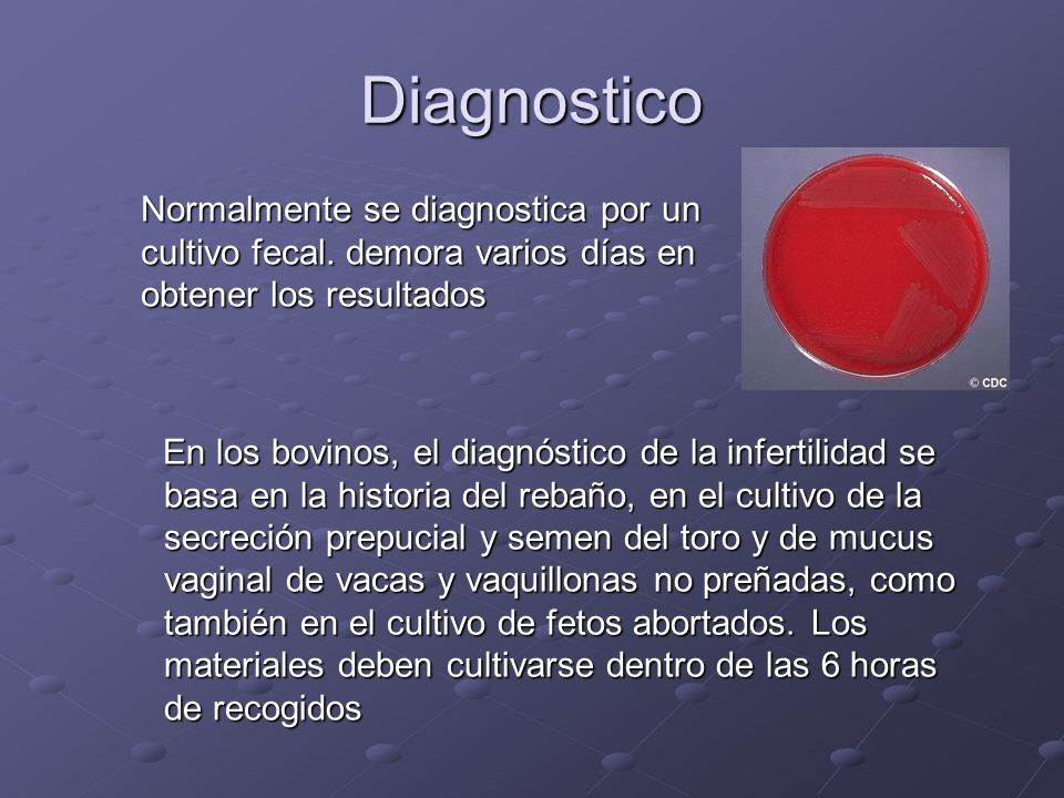 Diagnostico Normalmente se diagnostica por un cultivo fecal. demora varios días en obtener los resultados.